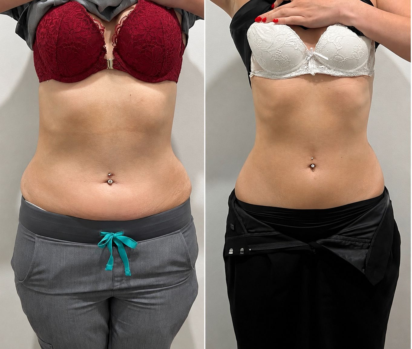 Result – Full Midsection