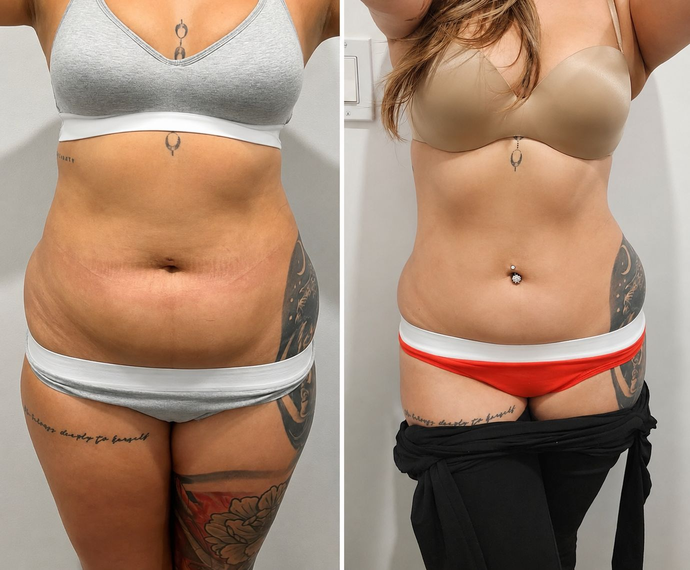 Result – Waist & Tummy